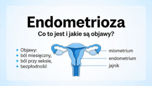 Endometrioza – dlaczego rozpoznanie tej choroby trwa tak długo? Komentarz ginekologa